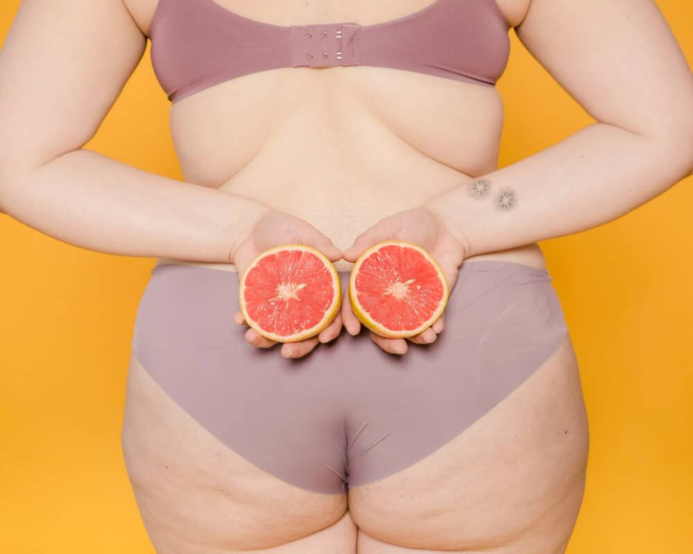 Home remedies for cellulite: which ones can help you?
